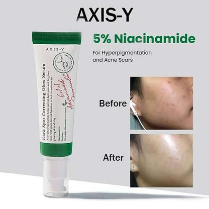 AXIS-Y Dark Spot Correcting Glow Serum - 50ml Brightening Treatment for Hyperpigmentation, Uneven Skin Tone & Dark Spots