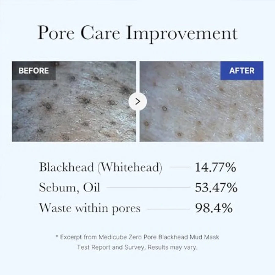 Zero Pore Black Mud Facial Mask - 3-Minute Cooling Pore Tightening with AHA/BHA/PHA, PorePurifying Clay Formula